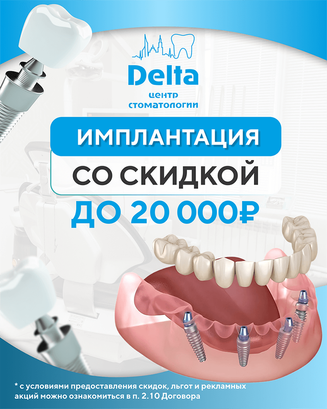 Скидка на имплантацию