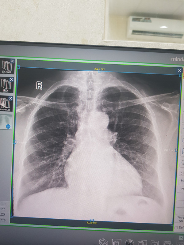 17702902075957474791608488447647