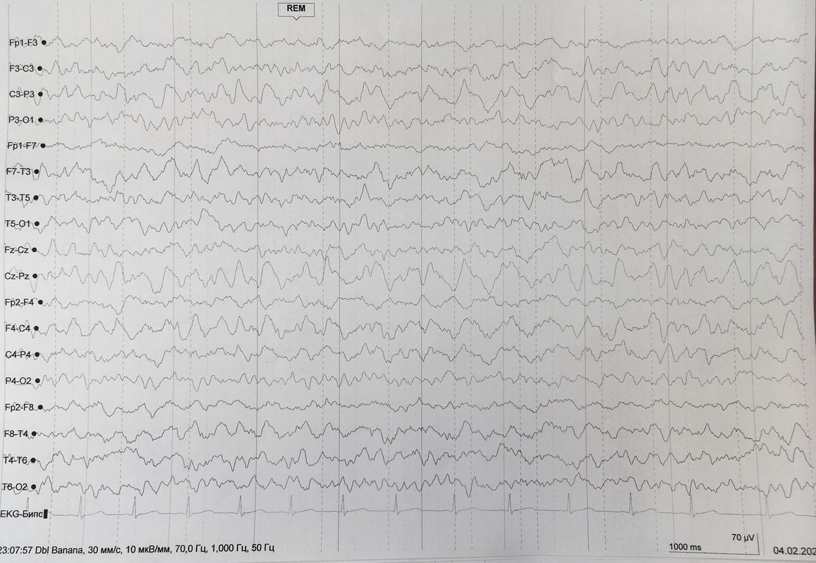 358C0287-50A1-4BA0-B362-A28629E6A0BA