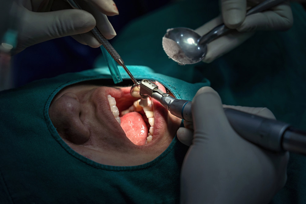 Minor Oral Surgeries
