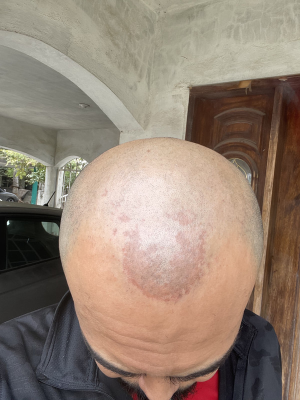 B76DE711-FE5B-4F21-9E71-361F287FB8CB