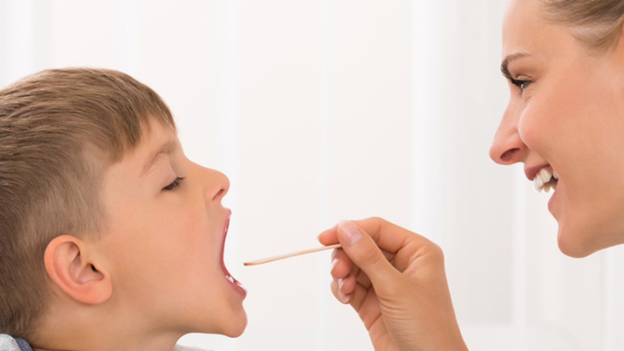 Gingivoestomatitis: podría aparecer como aftas en la boca de los niños