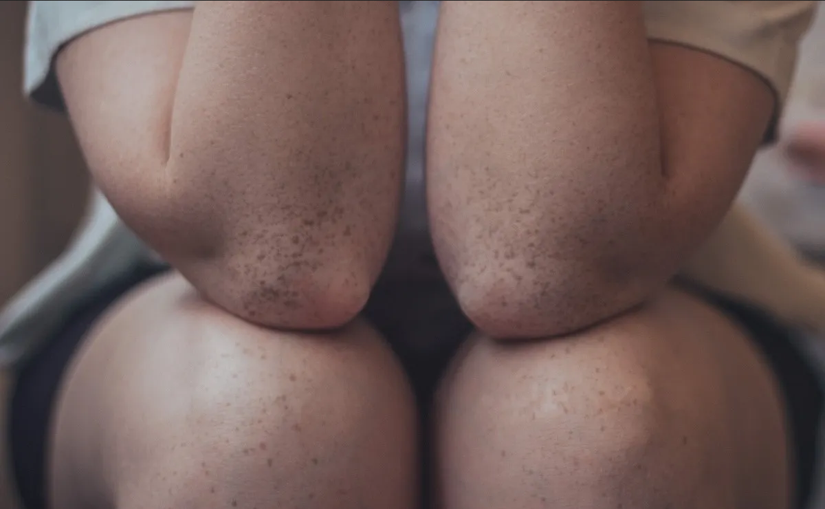 Así puedes quitar las manchas negras de los codos y rodillas utilizando avena