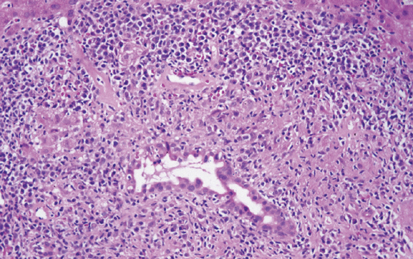 Gastroenterology question 1 image