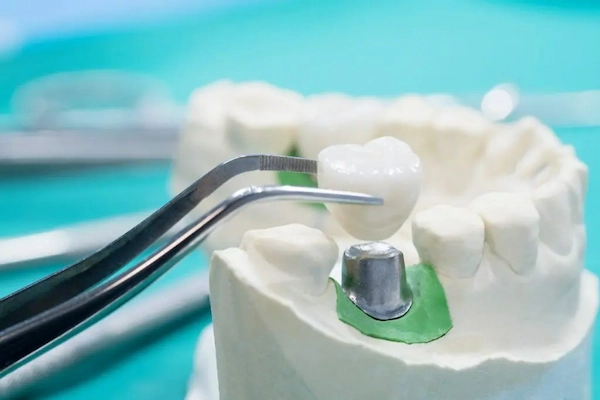 Dentalne krune