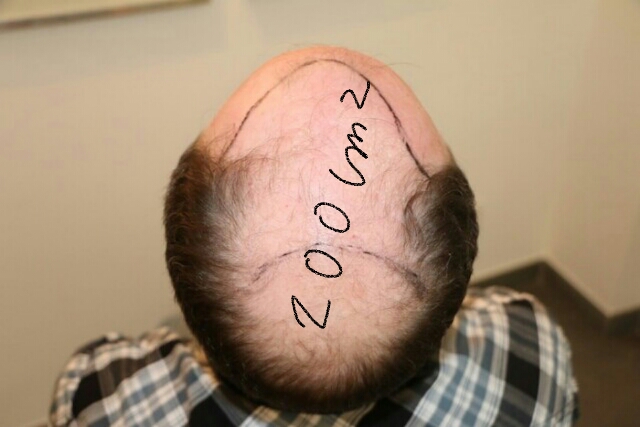2018-03-01 06.37.56