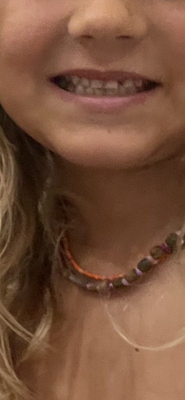 315B7CCE-0262-4DF1-966D-212D6F5DB0FF