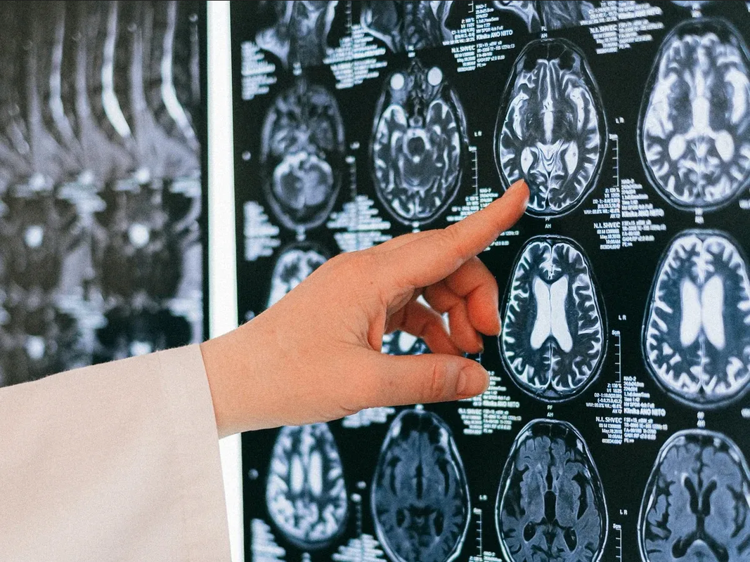 Científicos Resuelven Interrogante Mayor de la Ciencia: El Funcionamiento del Cerebro