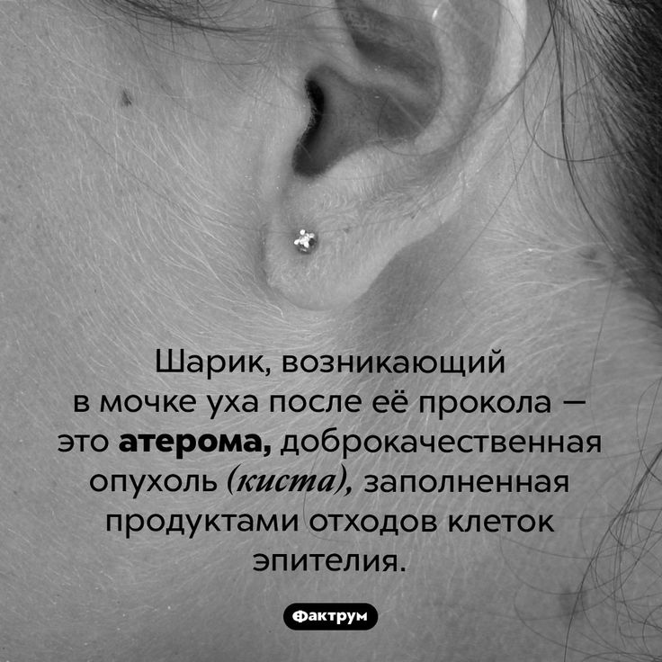 [Изображение: 116c776eeb9fafc244178ef09fb84f7f.jpg]