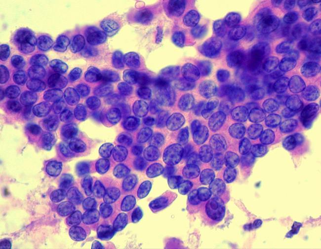 Oncology question 8 image