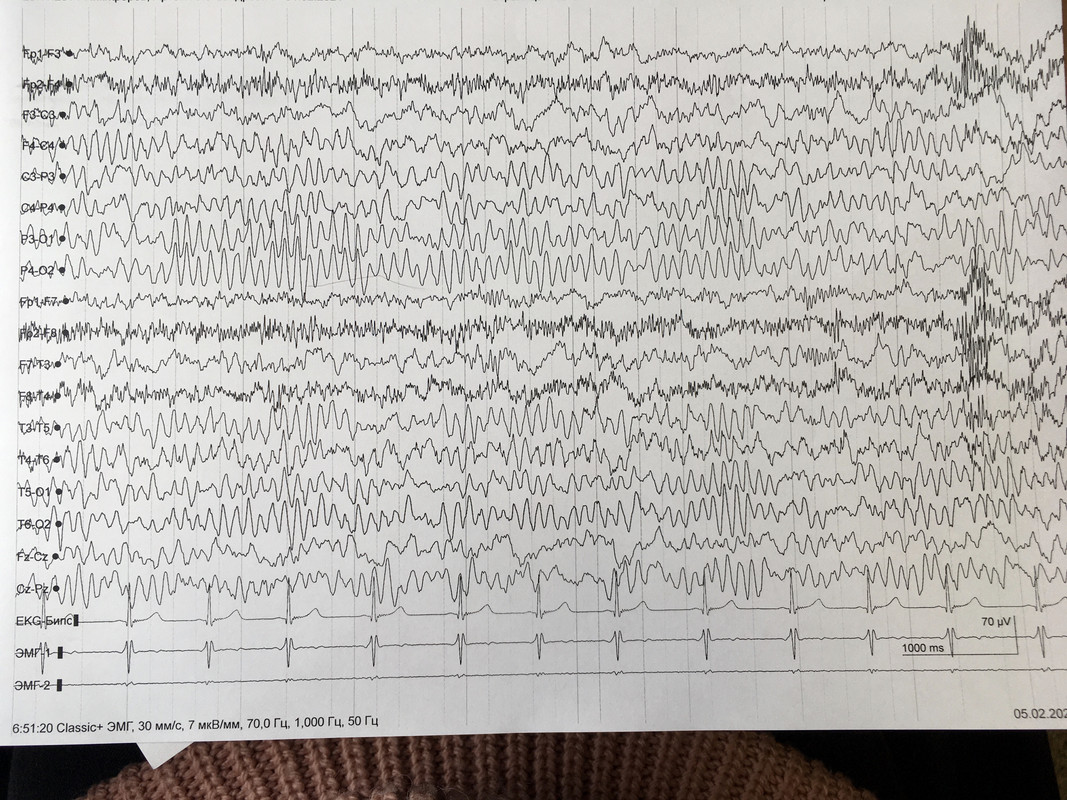 DE634A99-7A03-4AD6-87DF-2FBA190B0AEA