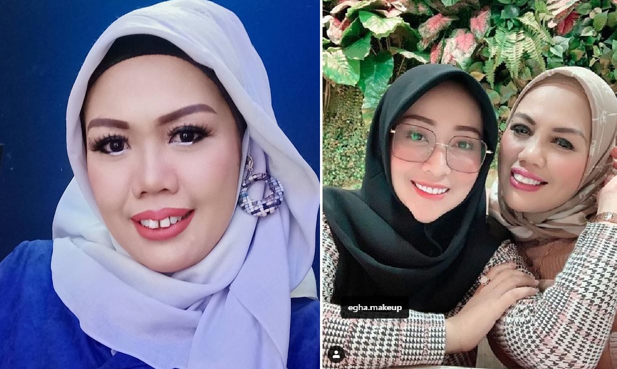 Elly Sugigi sebelum merapikan giginya (kiri) dan setelah merapikan giginya (kanan)