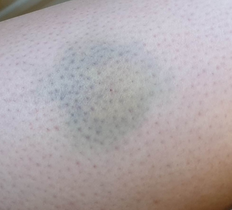 Screenshot_20250928_095238_Photos