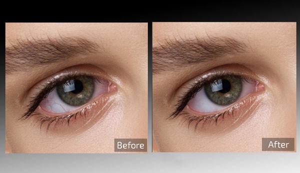 Descargar Retouch4me Eye Vessels 2024 Full Mega Gratis MediaFire o Google Drive Zdescarga PC Gratisprogramas