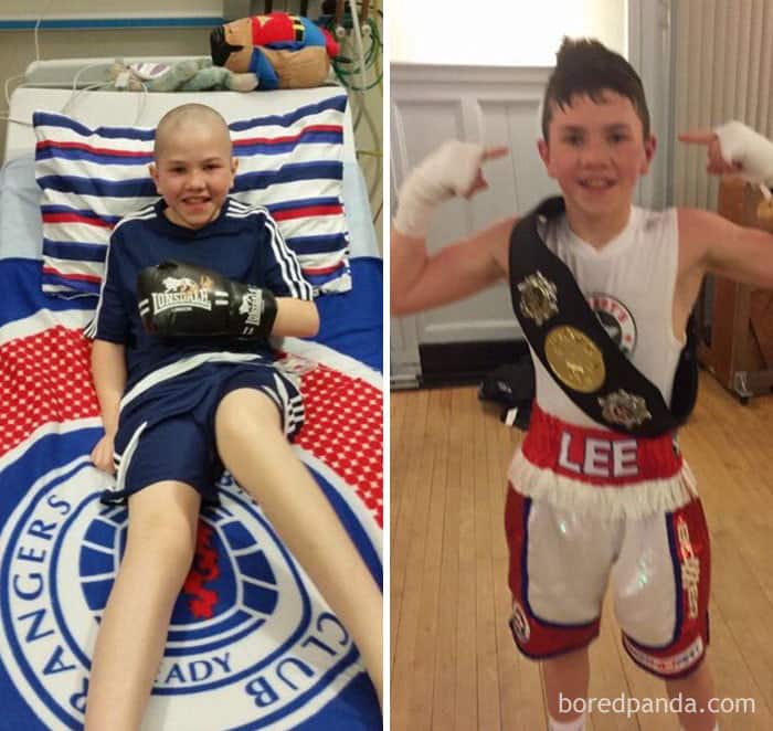 25 настоящих героев, которые победили в схватке с раком, и теперь здоровы и счастливы