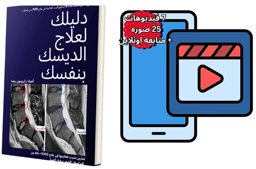 دليلك لعلاج الديسك بنفسك