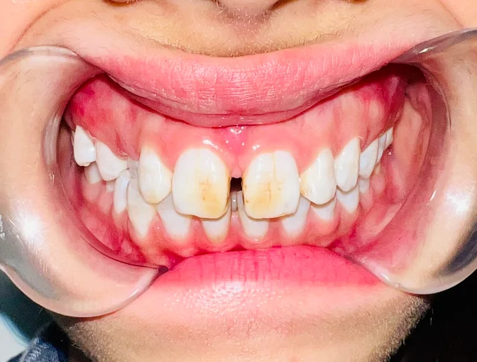 Professional dental treatment results CTM clinic