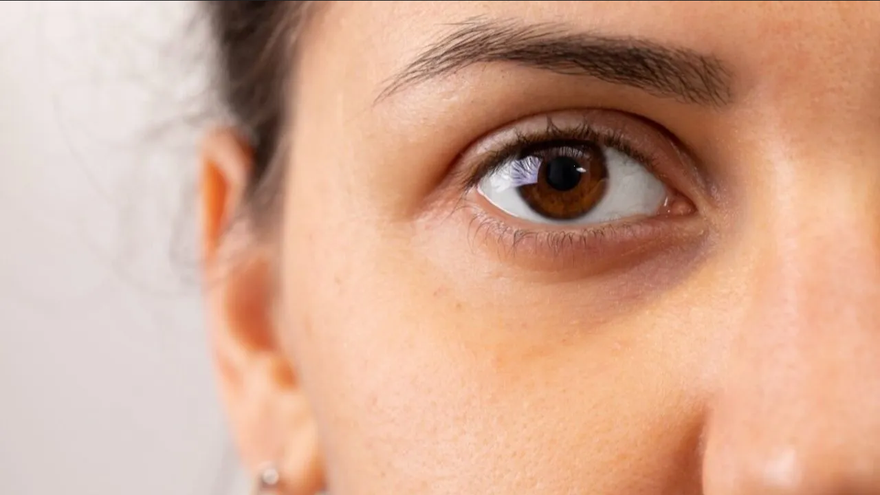 Elimina las ojeras y mejora tu vista con esta fruta roja
