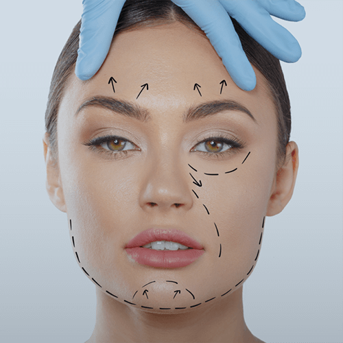 Preenchimento Olheiras