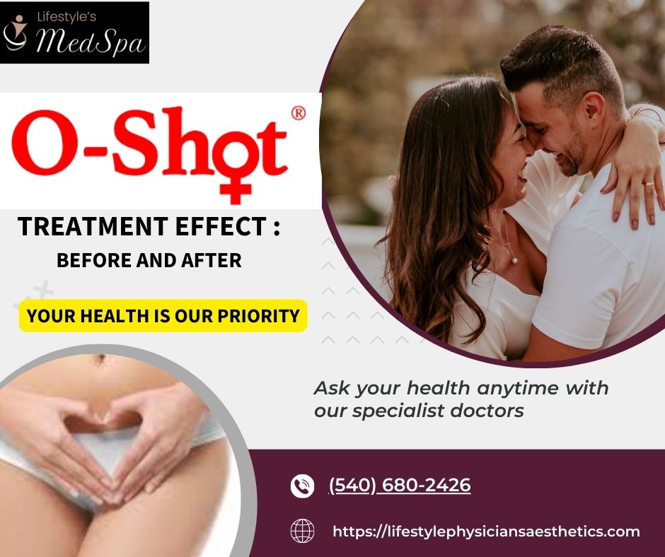 O-shot before and after