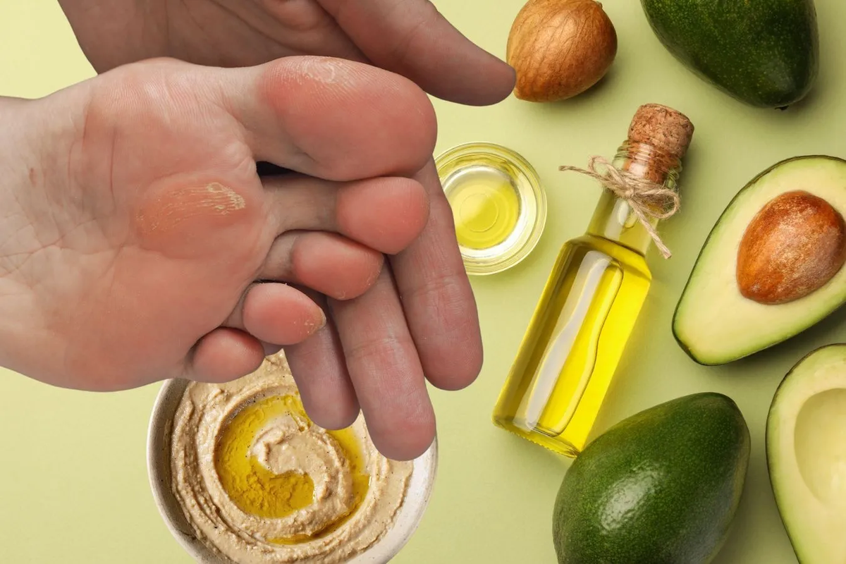 Suaviza los pies agrietados con este colágeno casero revitalizante