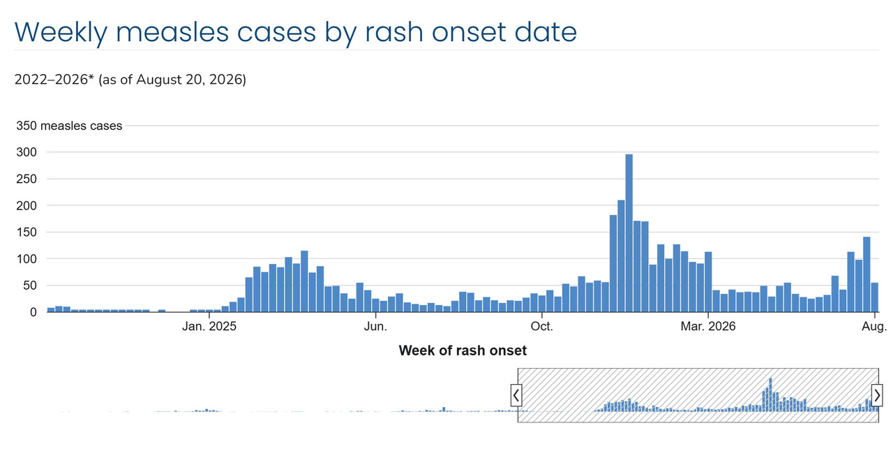 measles