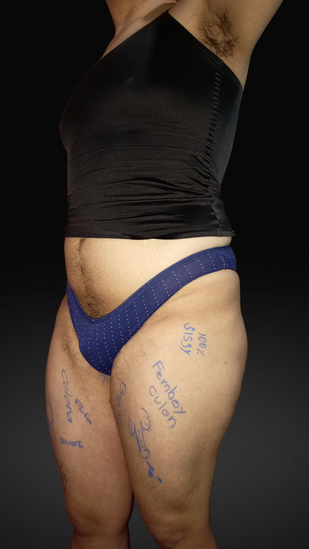 Mi culote
