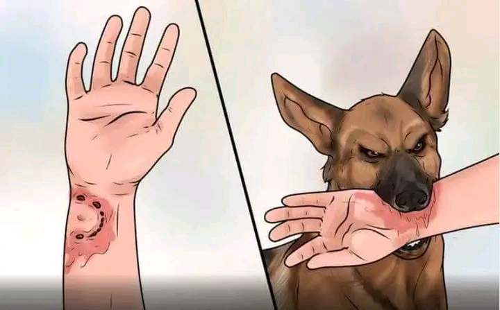Rabies awareness - dog bite