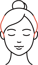 튀어나온 측두근