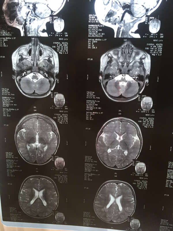 E74629A9-CA54-4E92-8228-99DED4B5C95D