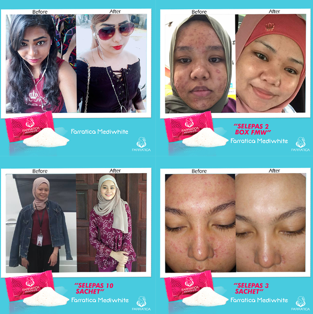 Mediwhite Serbuk Pemutih Seluruh Badan Mallmart My