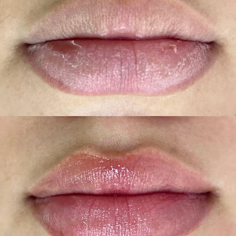 lips