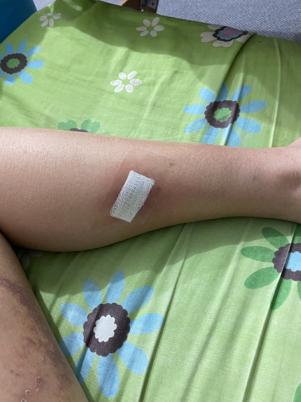 1A9F4BF4-DBFE-46C8-A122-A115BE01DFDA