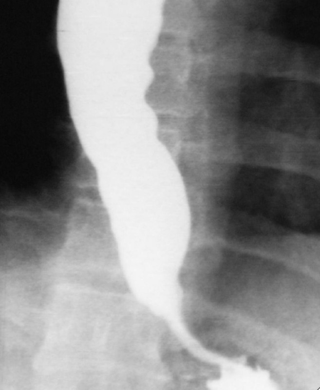 Gastroenterology question 2 image
