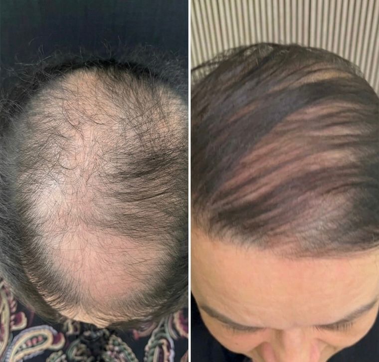 Resultado de Tratamento