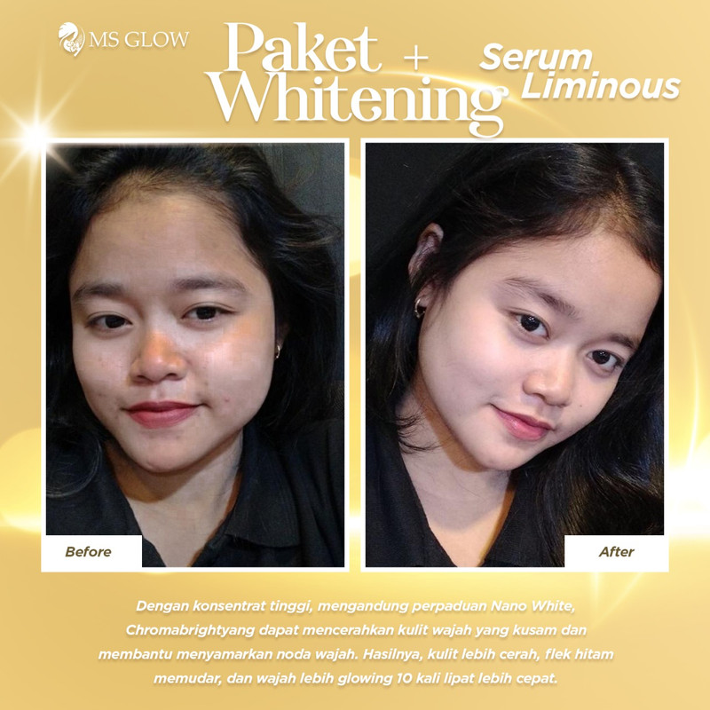 testimoni ms glow skin care