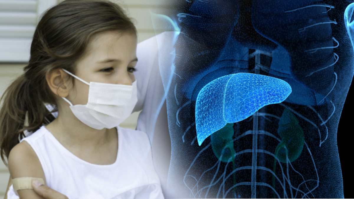 Hepatitis misteriosa en niños ya está en 20 países, se duplicaron en solo 10 días