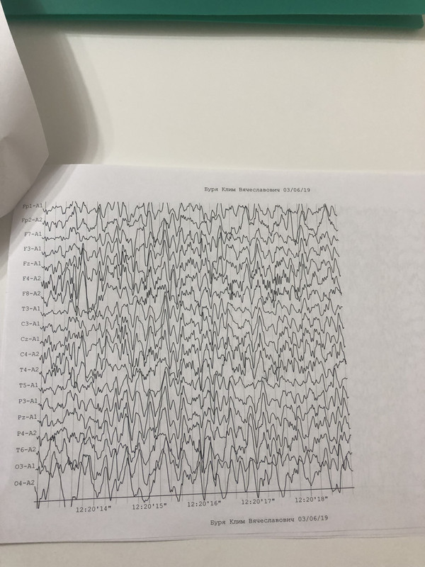 1AE37452-A295-4282-9CE9-B36810DDEB80