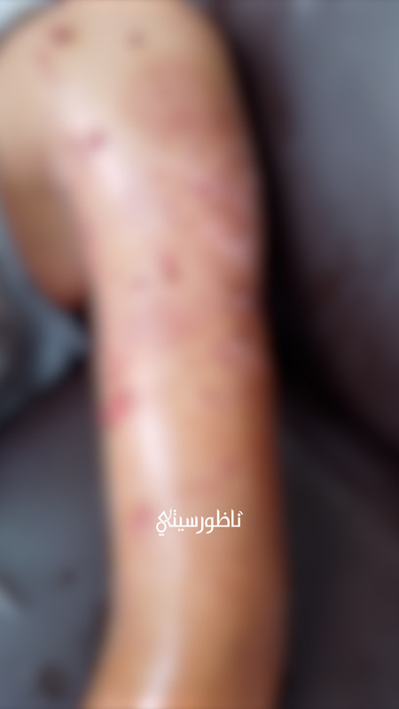 ALALI-L-00-17-56-23-Still021