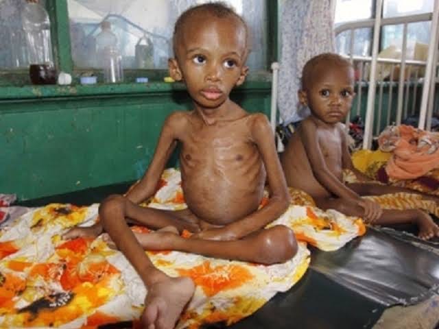 Children receiving nutrition support