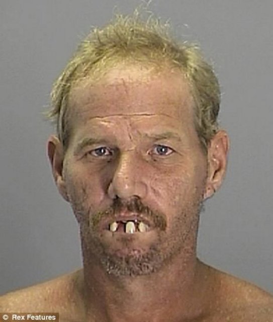 no teeth