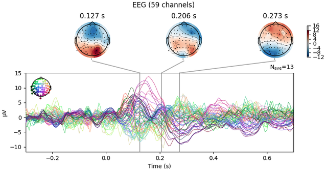 [Image: sphx-glr-30-eeg-erp-018.png]