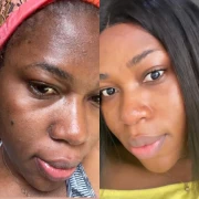 Before and After