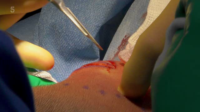 [Image: 2mktfhl89b2c.png]