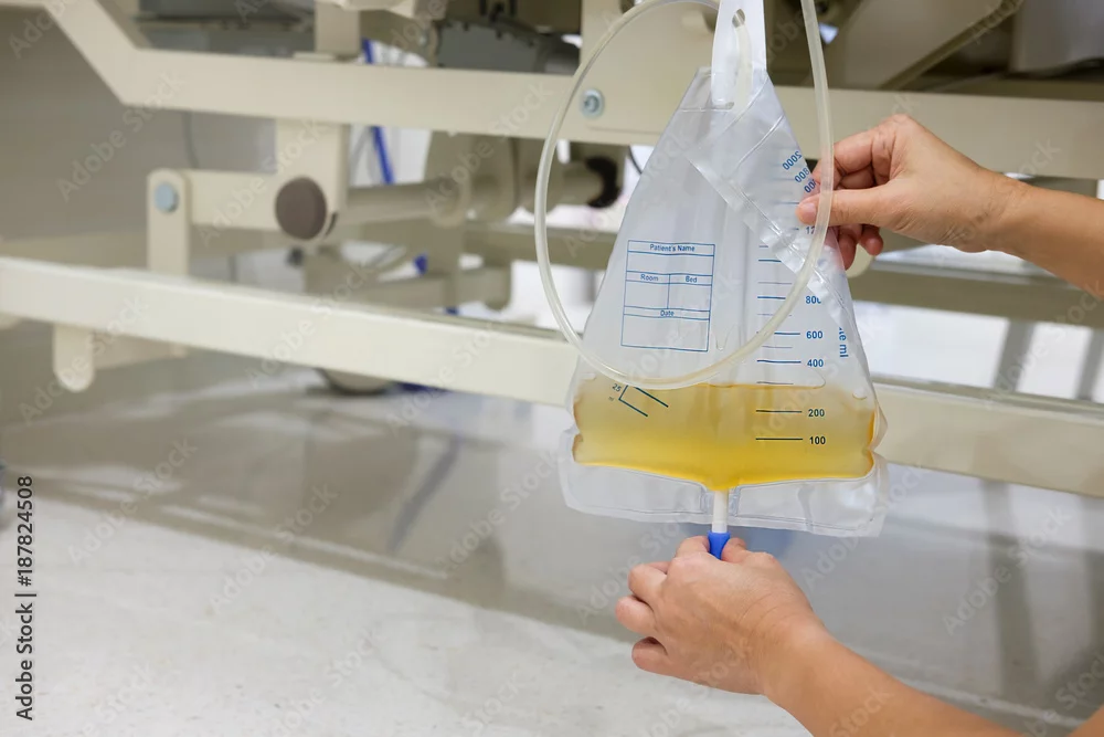 Urinary Catheter Service