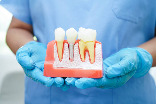 soins dentaires à l'étranger