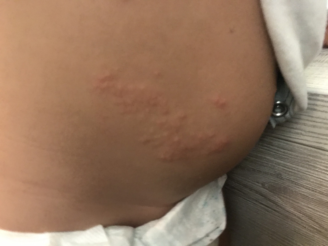 F68D4482-96C4-45DD-A755-2812749ED3B4