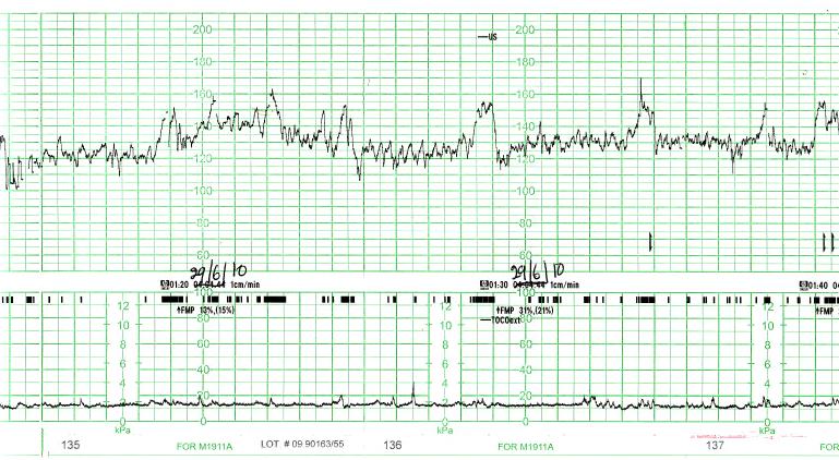 Obstetrics question 10 image
