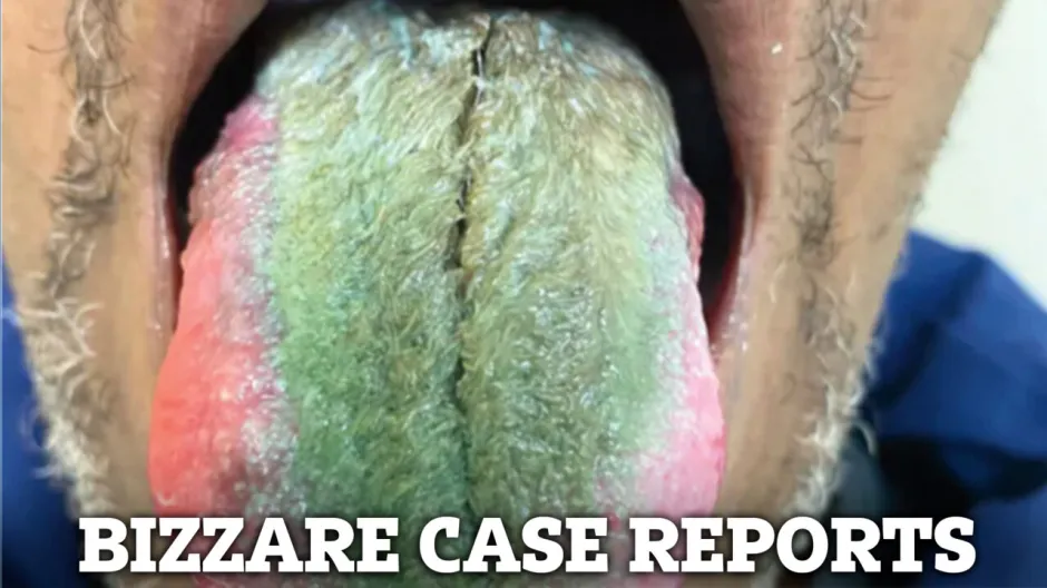 bizarre-medical-case-reports-dd9048