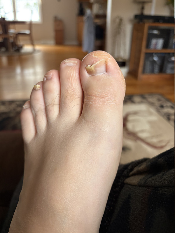 IMG 9325